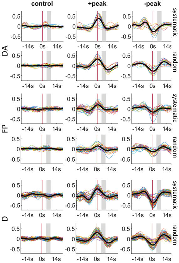 The interaction between random and systematic visual stimulation and
                    infraslow quasi-periodic spatiotemporal patterns of whole-brain
                    activity